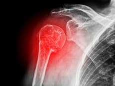Ｆｒｏｚｅｎ Ｓｈｏｕｌｄｅｒに掲載されていた画像